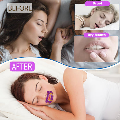 Mouth Tape For Sleeping