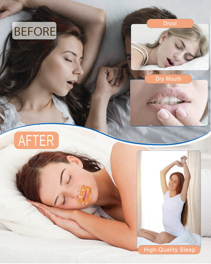 Mouth Tape For Sleeping（For Dry Skin）