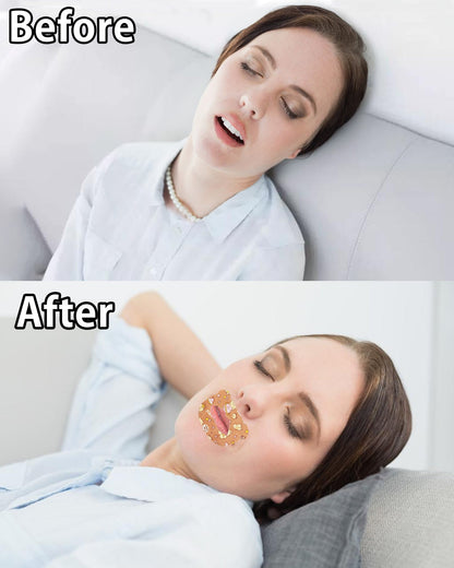 Mouth Tape For Sleeping（For Dry Skin）